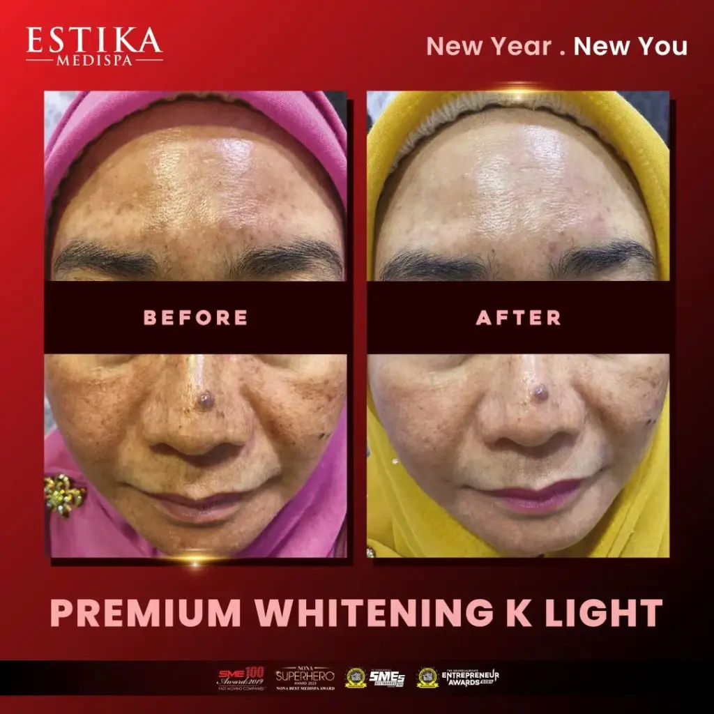 Estika Medispa
