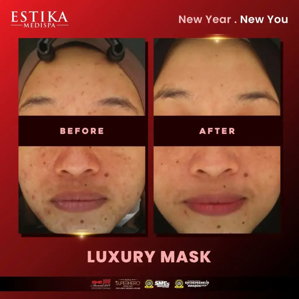 Estika Medispa