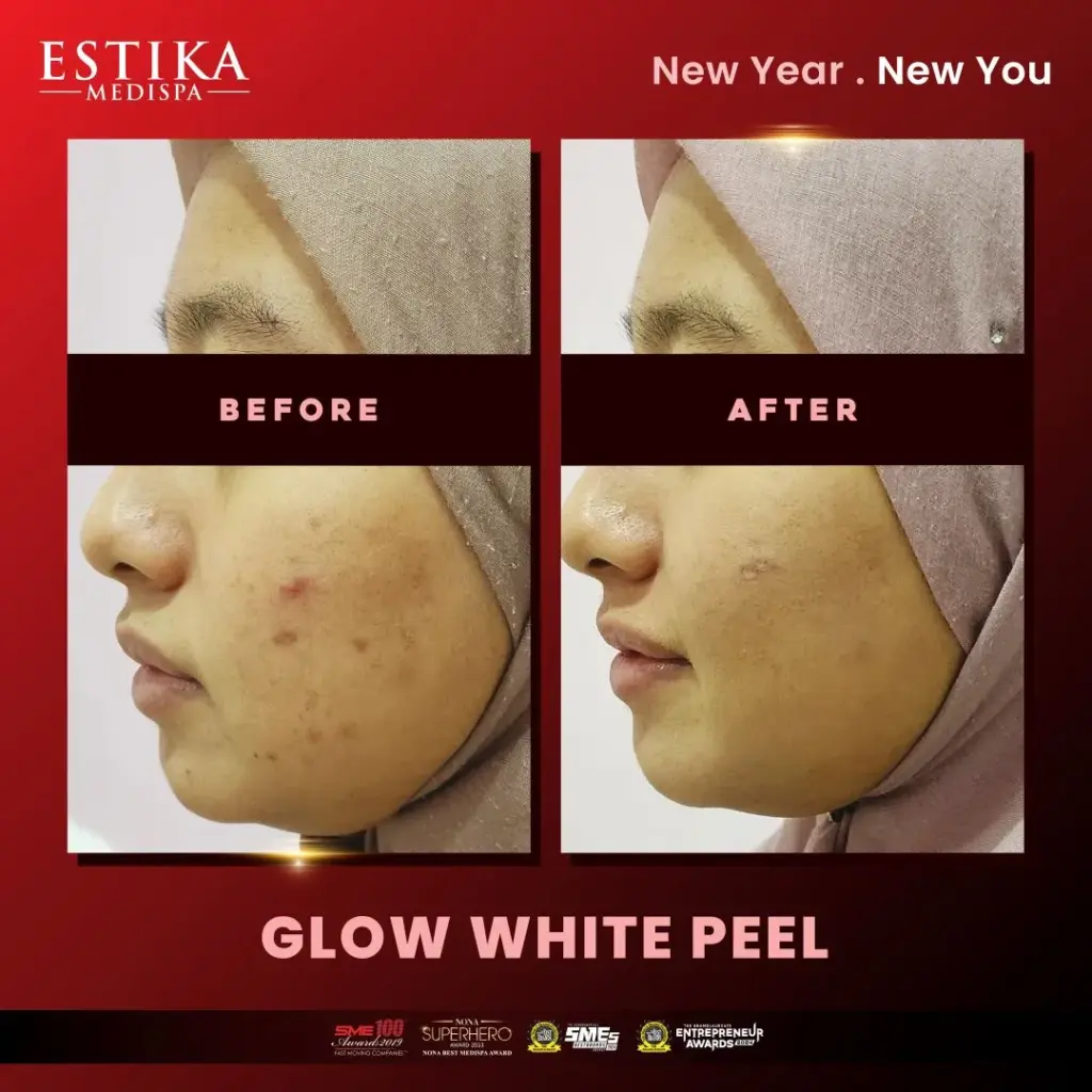 Estika Medispa