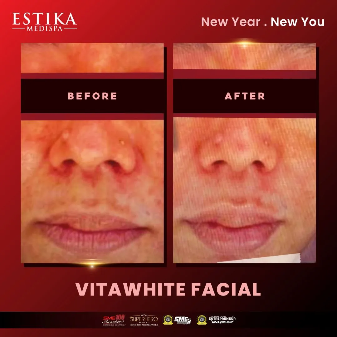 Estika Medispa