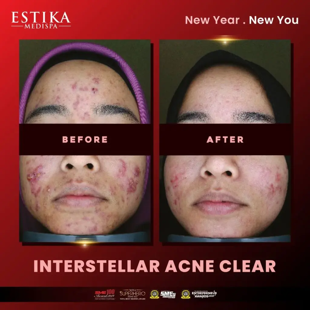 Estika Medispa