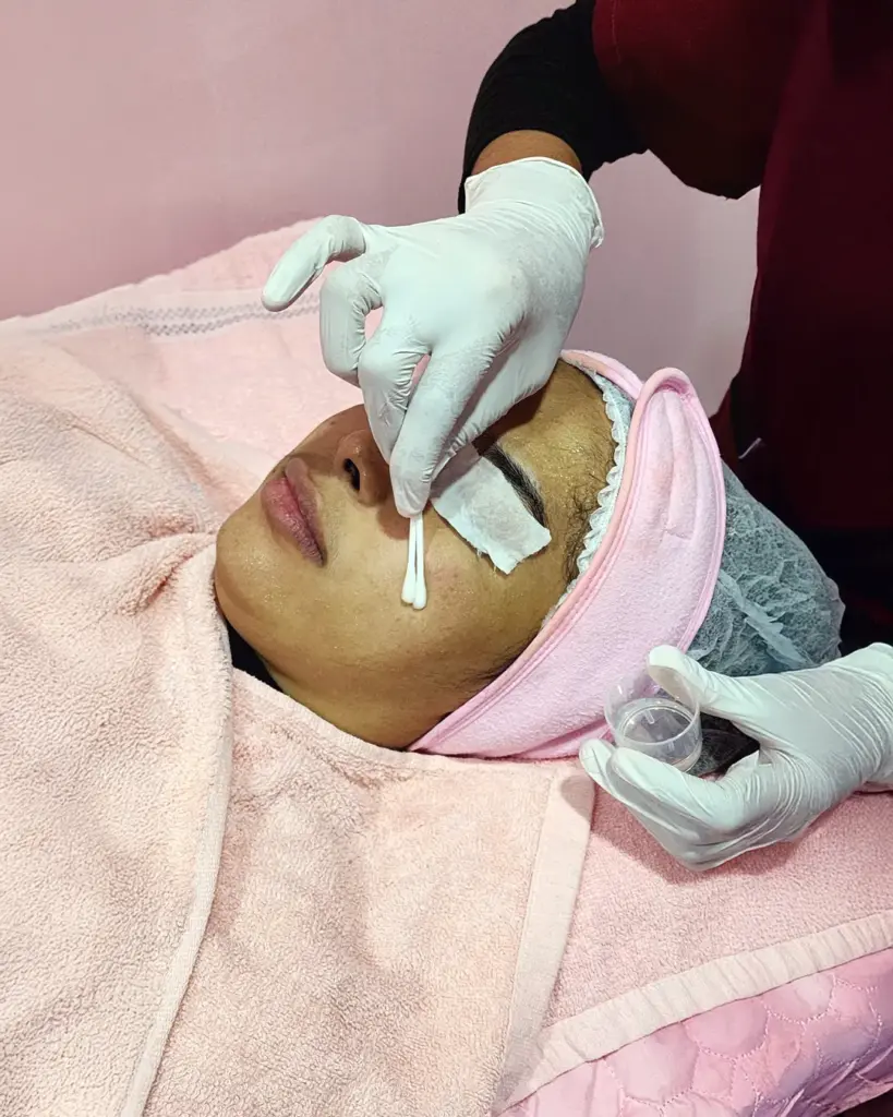 Interstellar Acne Clear