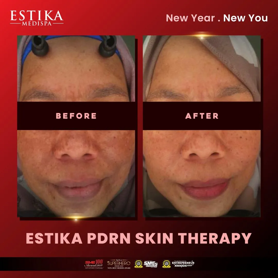 Estika Medispa