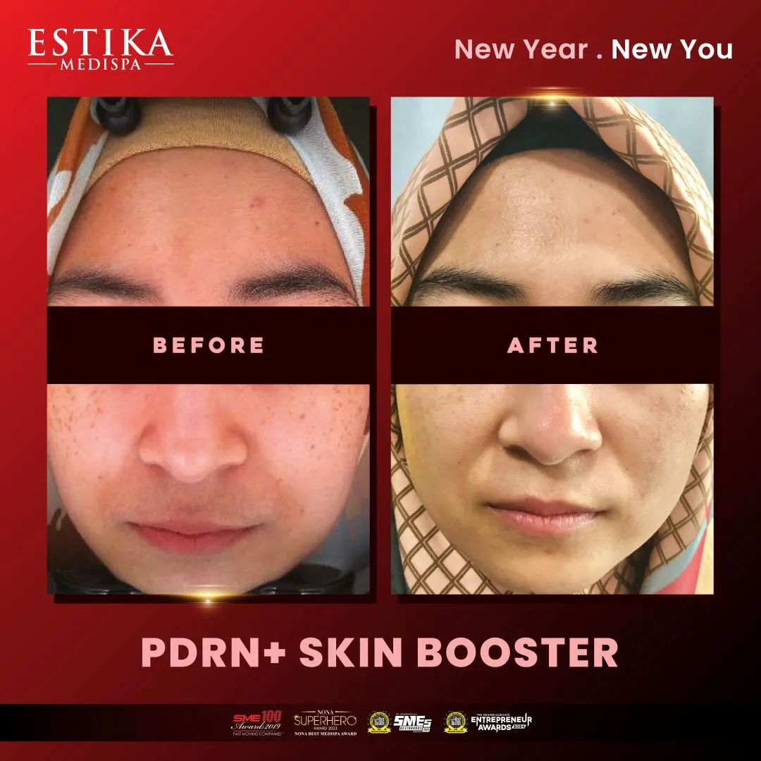 Estika Medispa