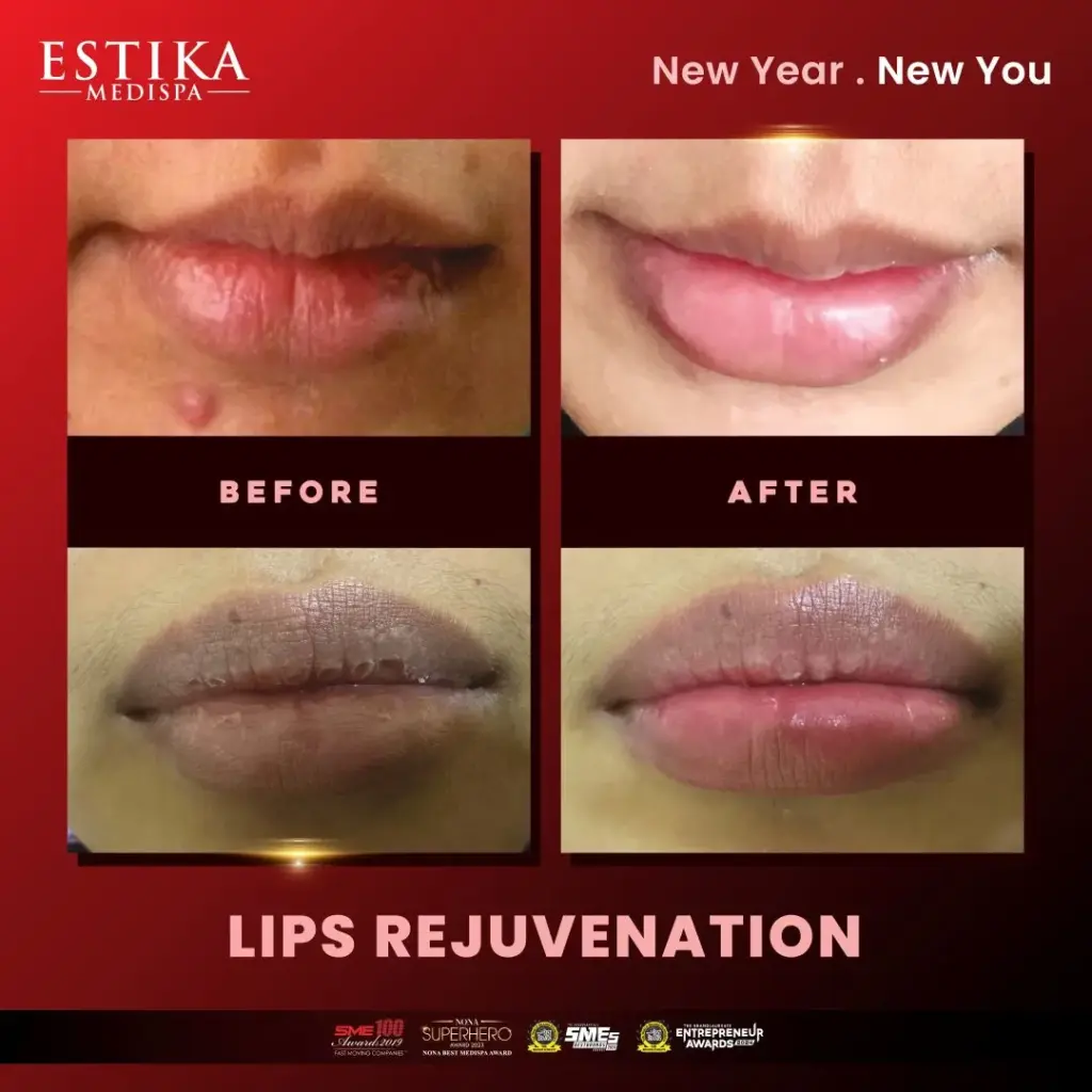 Estika Medispa