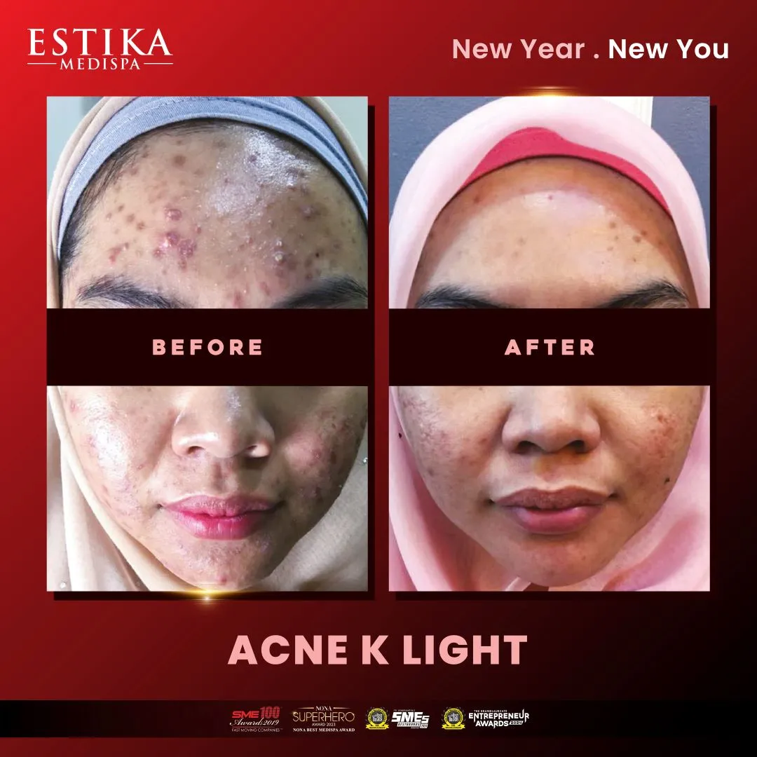 Estika Medispa