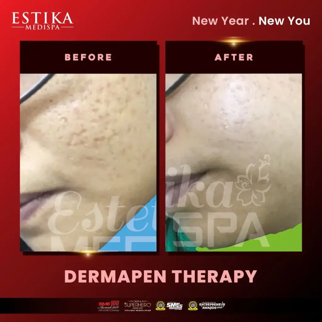 Estika Medispa