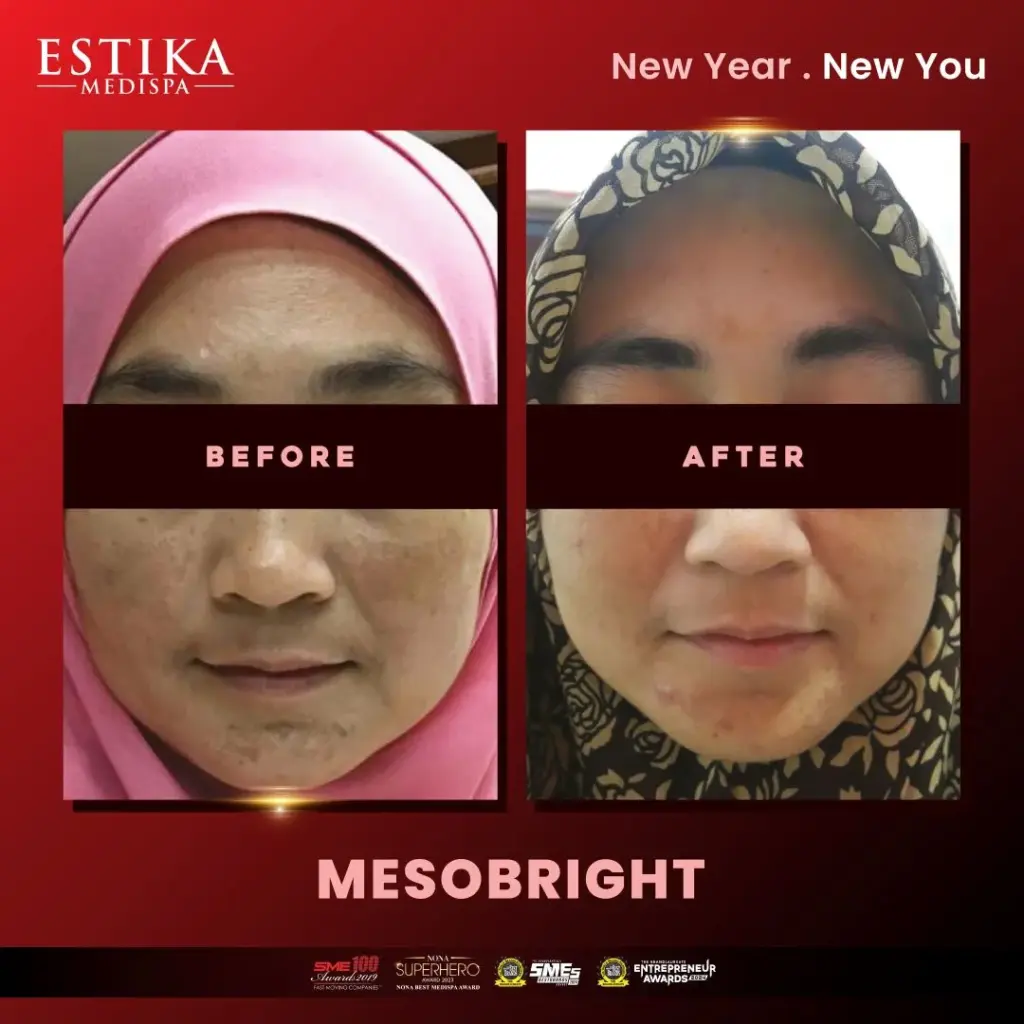 Estika Medispa