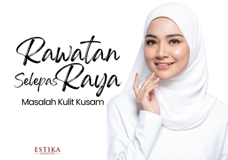 rawatan selepas raya