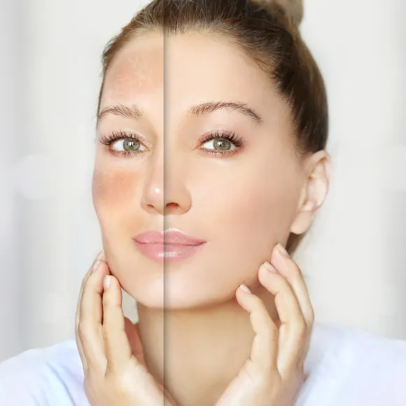 uneven skin tone problem