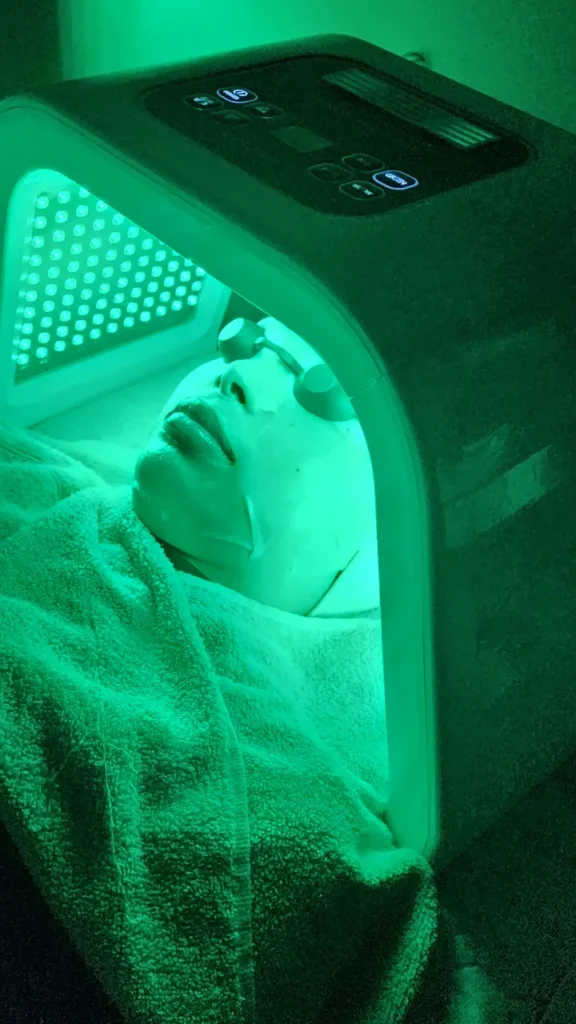 dermabright peel therapy