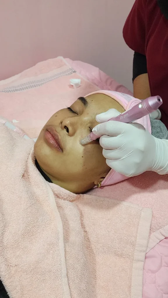 micropeel estika