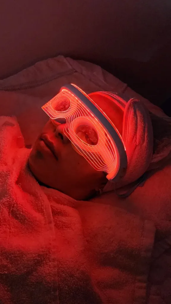 under eye treatment