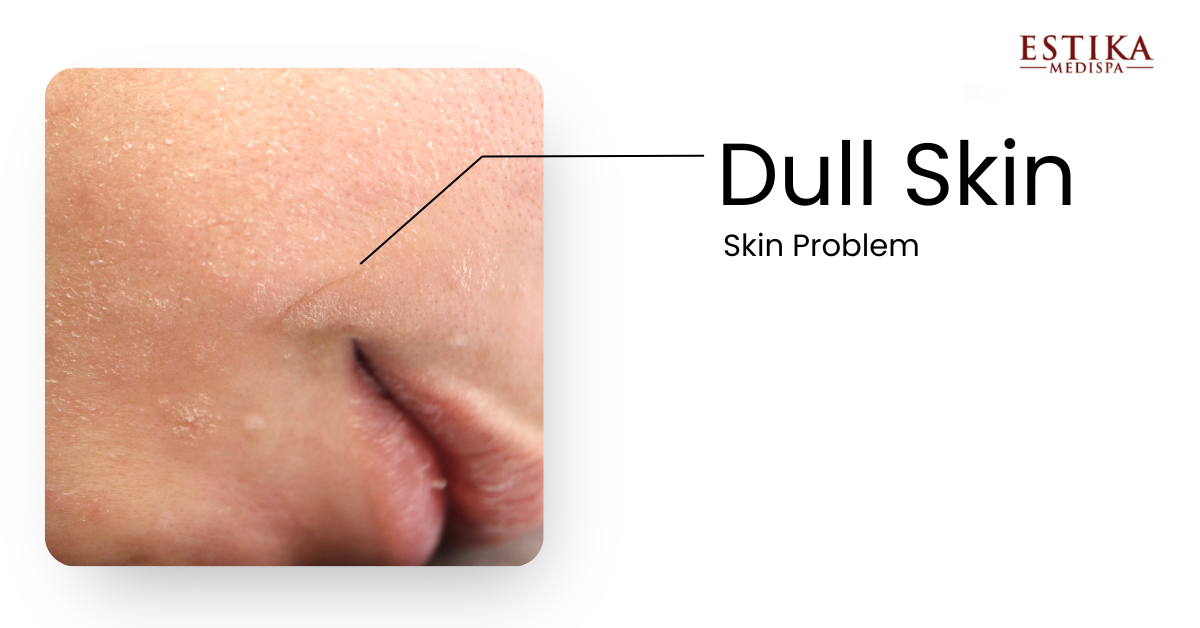 brightening facial for dull skin face