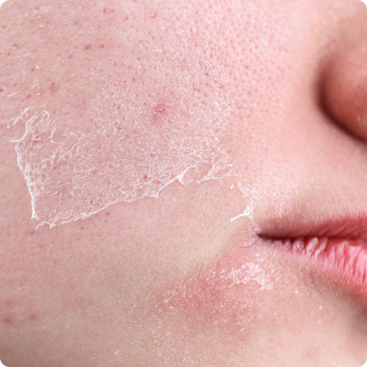 face wash for dry skin