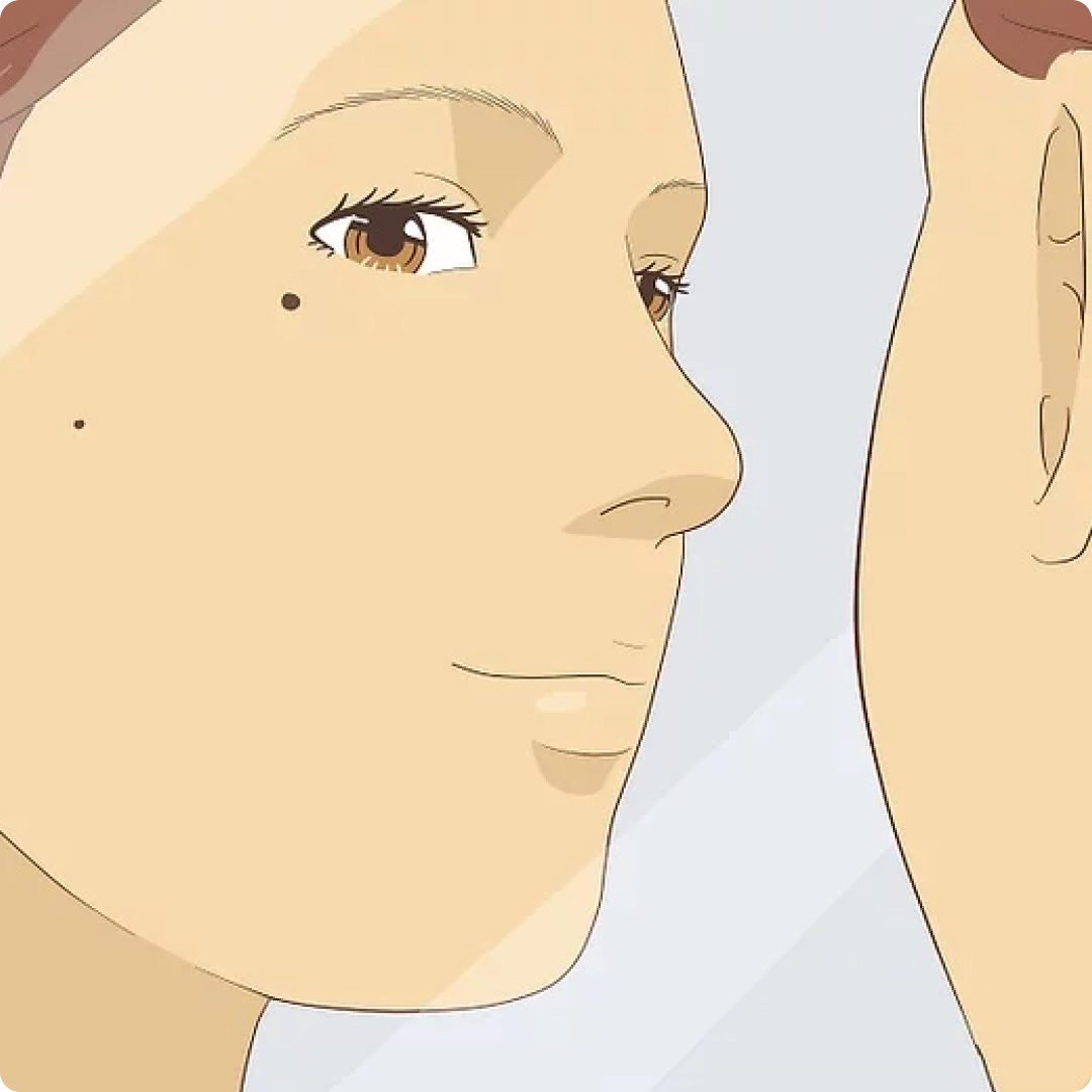 mole removal skin estika medispa
