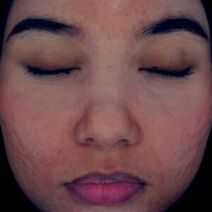 testimonial estika medispa (1)