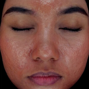 Estika Medispa