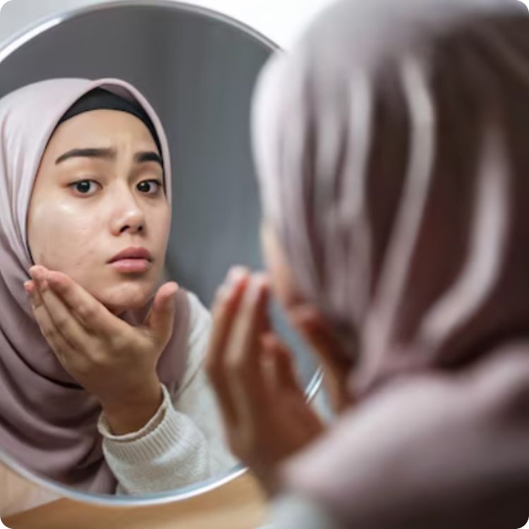 Estika Medispa types of skin problems