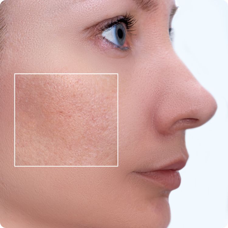 Estika Medispa types of skin problems