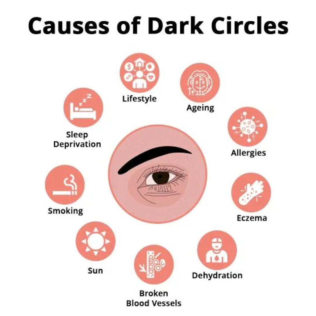 under eye treatment for dark circles