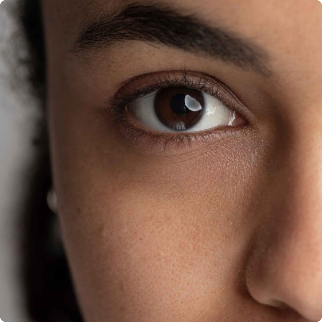 under eye treatment for dark circles