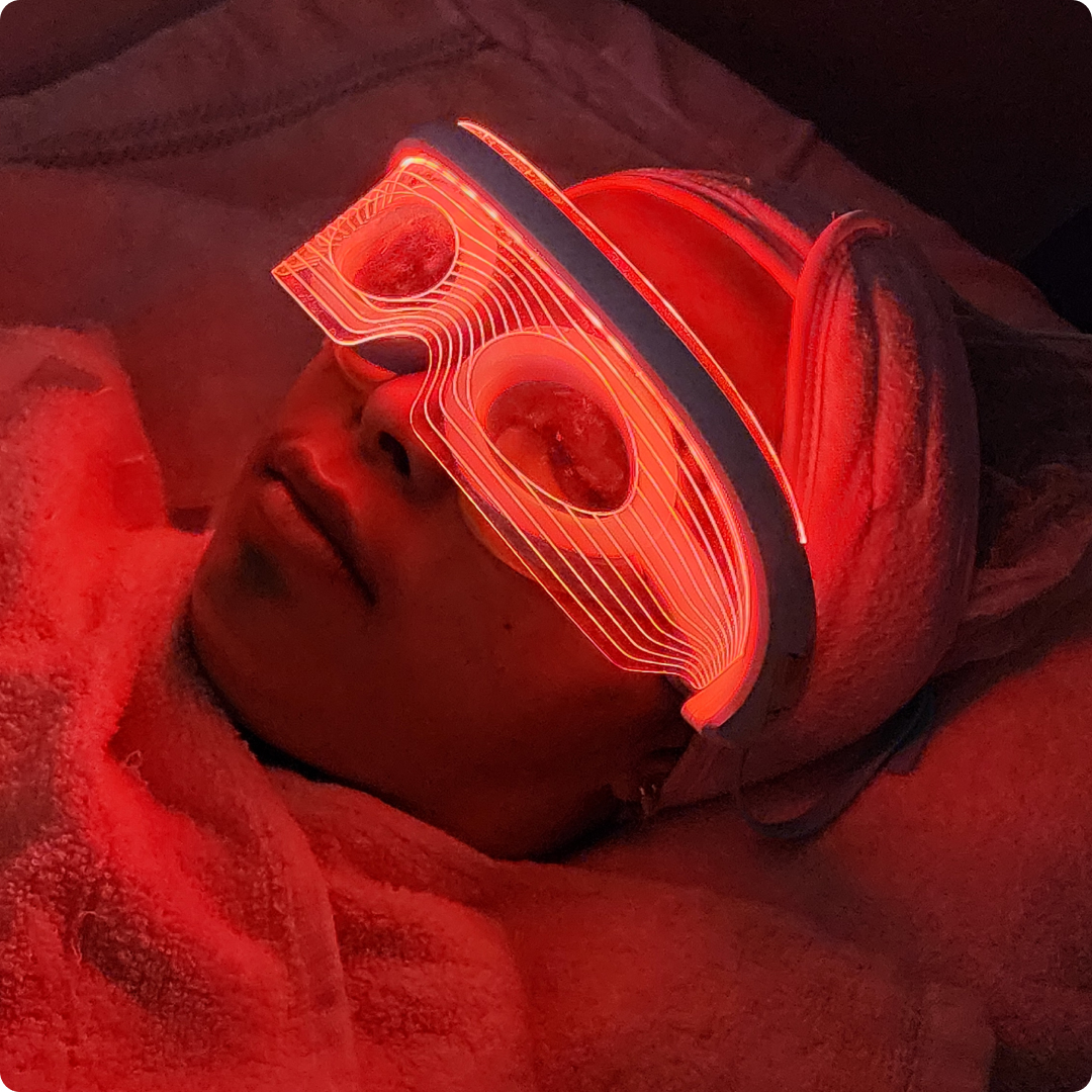 under eye treatment for dark circles