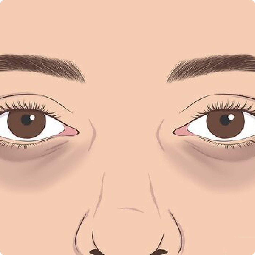under eye treatment for dark circles