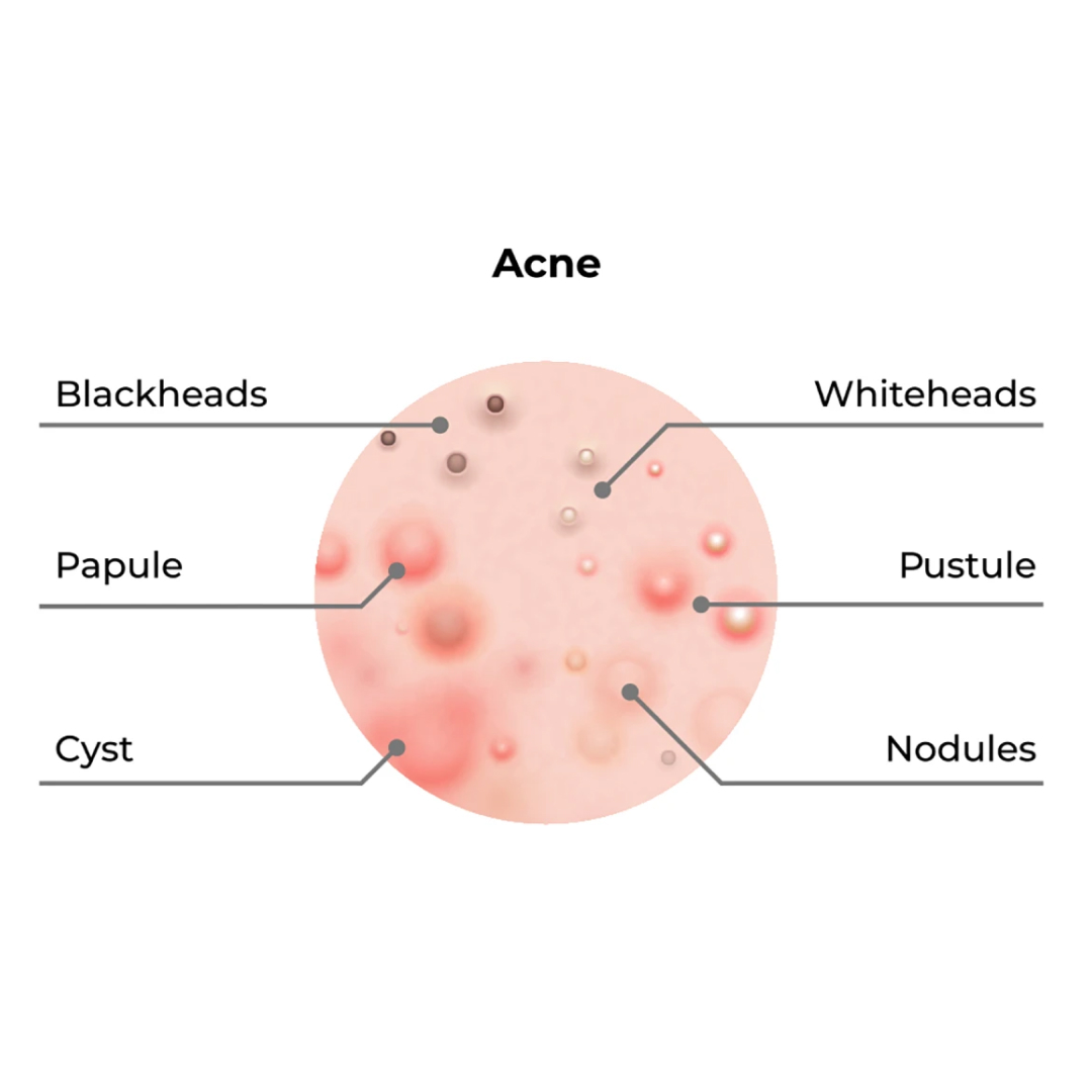 understanding ice cold facial treatment