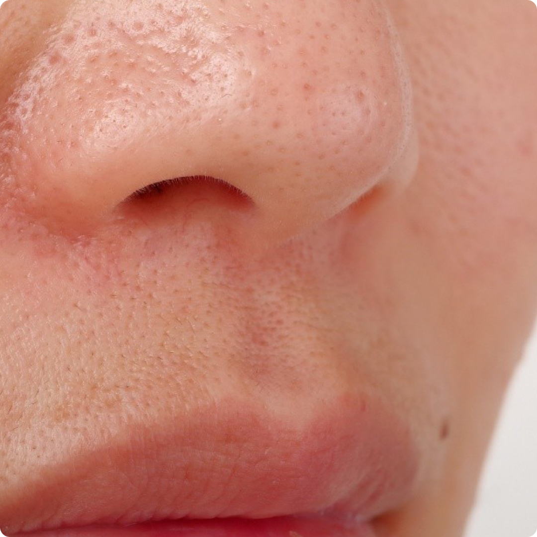 understanding ice cold facial treatment 