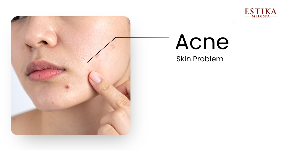 understanding ice cold facial treatment 