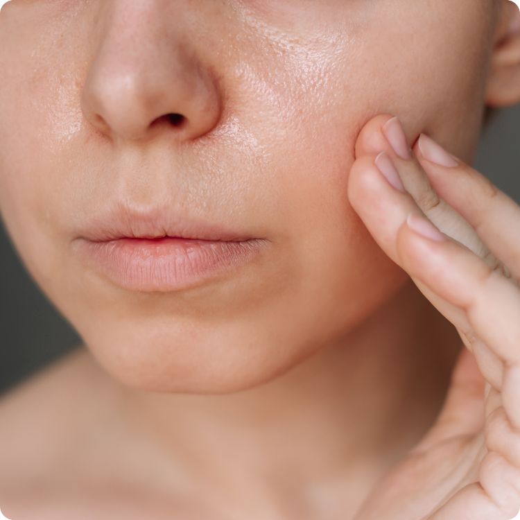 open pores treatment