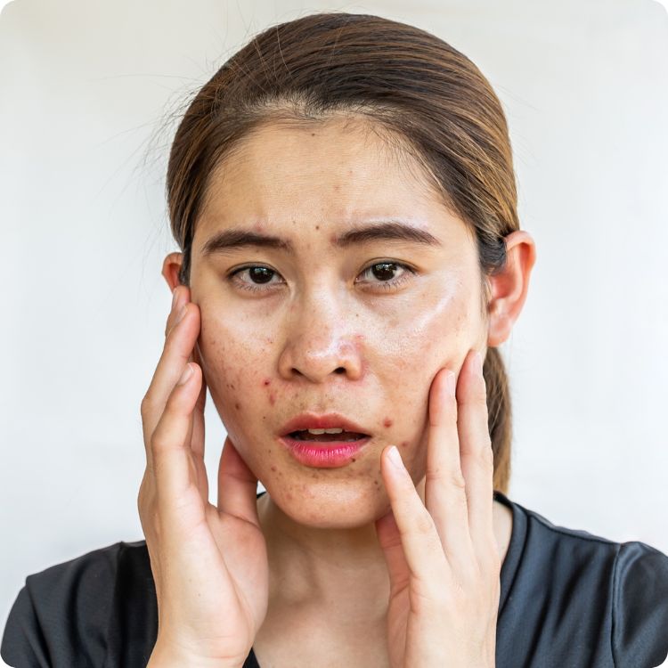 skin care routine for oily skin
