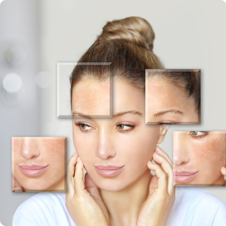 lhala treatment