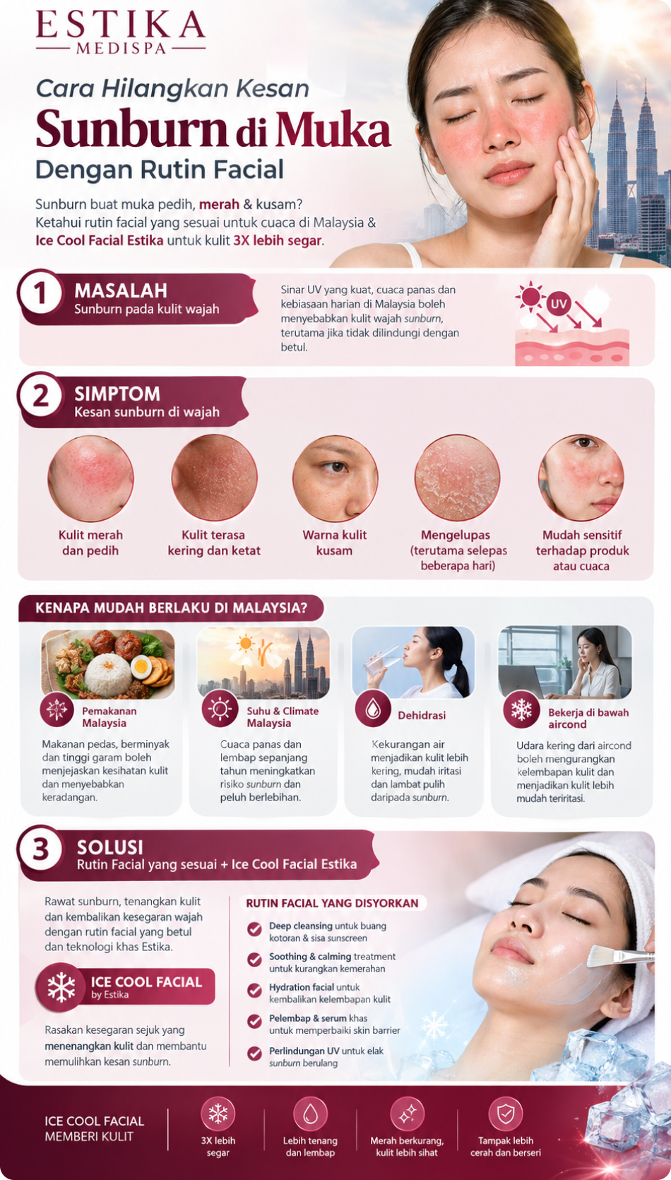 infografik sunburn di muka