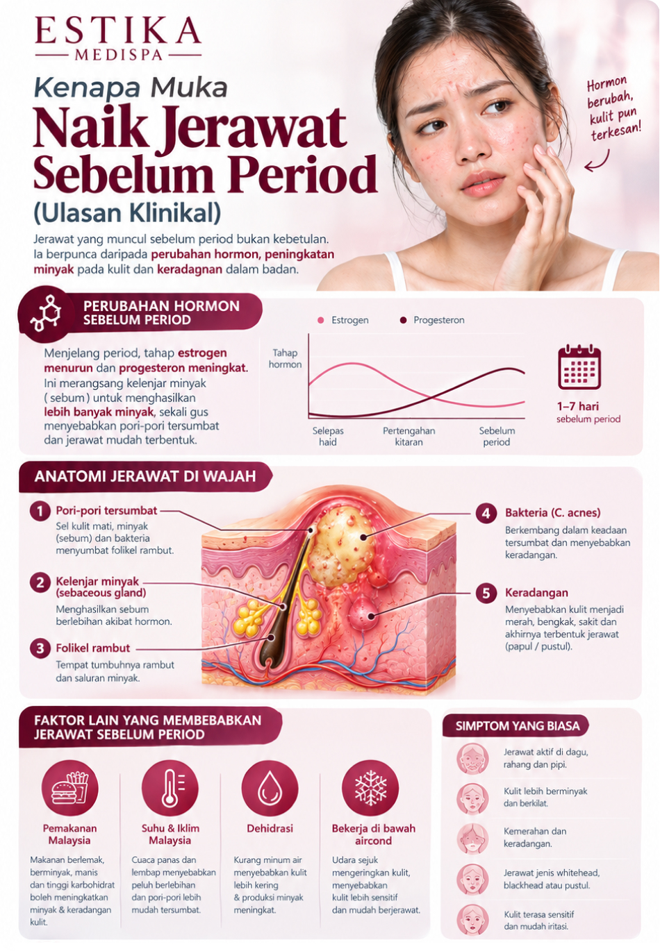infografik jerawat sebelum period