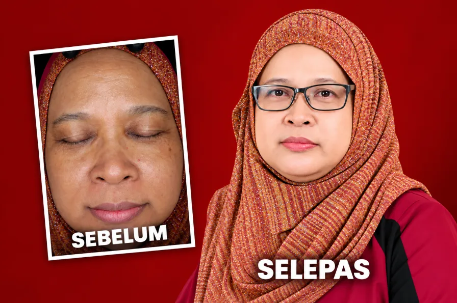 Estika Medispa puan zalina estika medispa testimonial