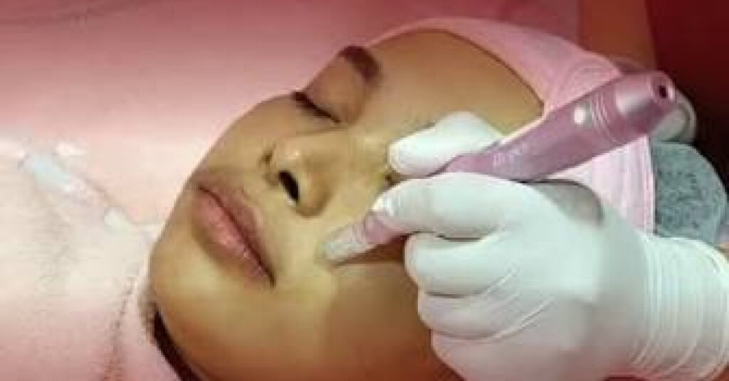 rawatan parut keloid