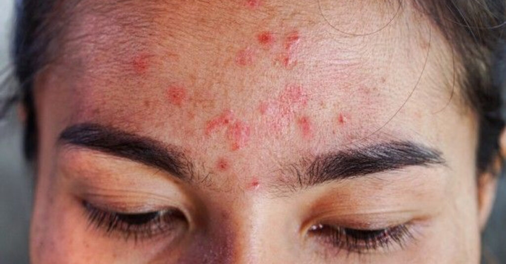 Estika Medispa