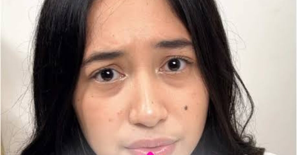 kulit muka pedih selepas pakai skincare